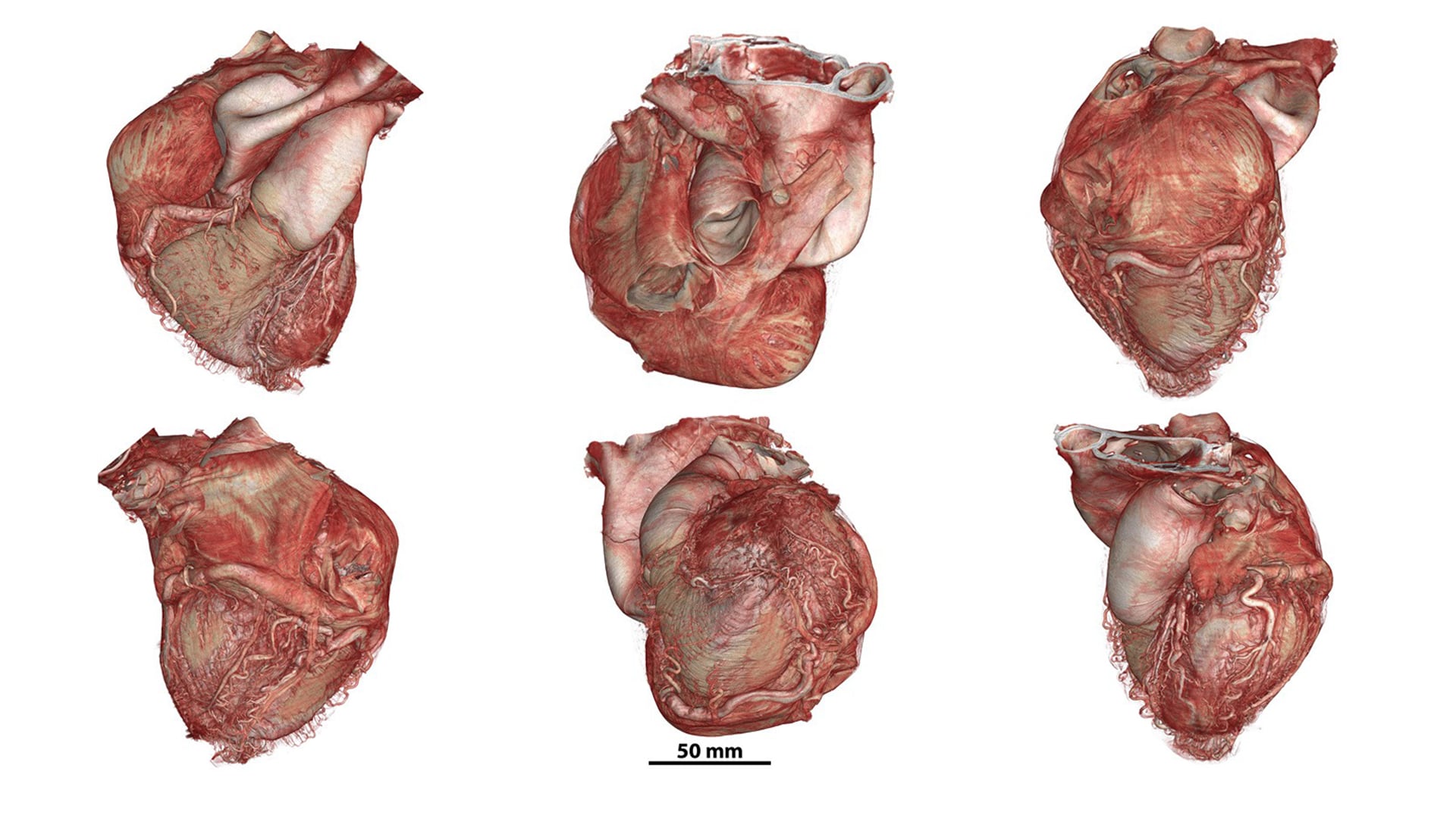 Un nuevo atlas interactivo permite ver el cuerpo humano como nunca antes